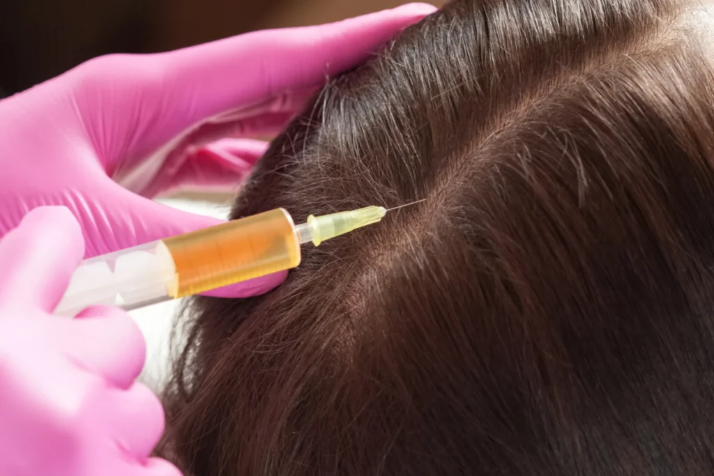 gfc treatment in kochi