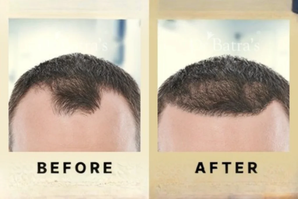 hair fall evaluation and treatment