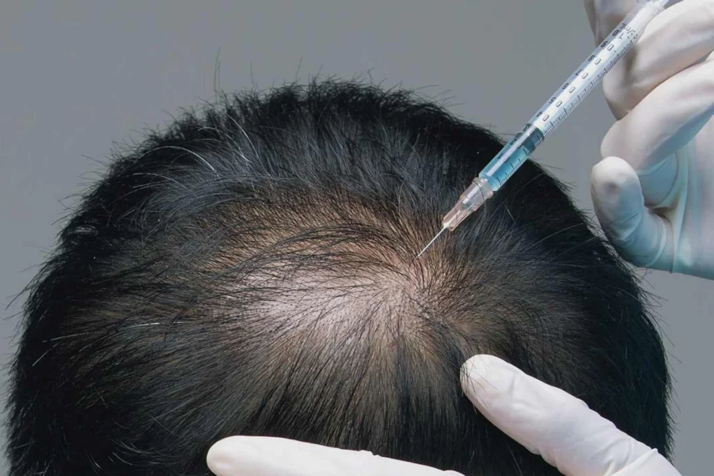 hair treatment in kochi