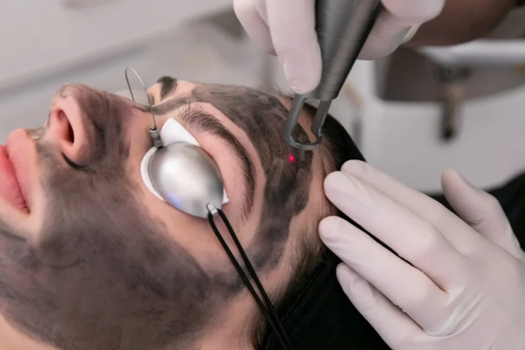 laser treatment kochi